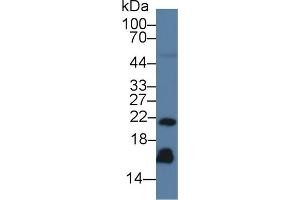 Western Blot; Sample: Human Serum; Primary Ab: 3µg/ml Mouse Anti-Human REG3g Antibody Second Ab: 0. (REG3g antibody  (AA 39-175))