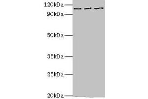 Western blot All lanes: MERTK antibody at 10 μg/mL Lane 1: Mouse gonad tissue Lane 2: Mouse lung tissue Lane 3: Mouse kidney tissue Secondary Goat polyclonal to rabbit IgG at 1/10000 dilution Predicted band size: 110 kDa Observed band size: 110 kDa (MERTK antibody  (AA 840-999))
