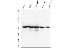Western blot analysis of GPI using anti-GPI antibody (ABIN4886609).