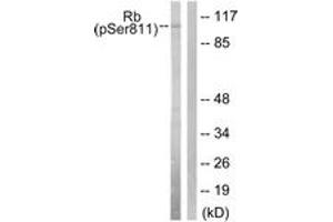 Western blot analysis of extracts from K562 cells, using Retinoblastoma (Phospho-Ser811) Antibody. (Retinoblastoma Protein (Rb) antibody  (pSer811))