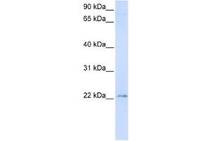 TMEM9 antibody used at 1 ug/ml to detect target protein. (TMEM9 antibody  (C-Term))