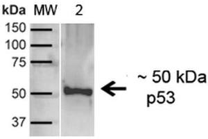 Western blot analysis of Human A431 showing detection of ~43. (p53 antibody  (C-Term) (FITC))