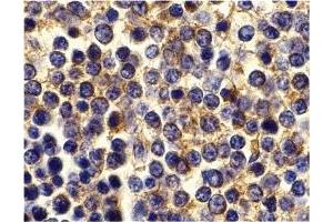 Immunohistochemistry (IHC) image for anti-Tumor Necrosis Factor Receptor Superfamily, Member 17 (TNFRSF17) (C-Term) antibody (ABIN1030288)