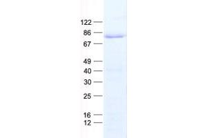 Validation with Western Blot (TCF3 Protein (His tag))