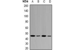 Western blot analysis of Fumarylacetoacetase expression in HepG2 (A), MCF7 (B), mouse liver (C), rat kidney (D) whole cell lysates. (FAH antibody)