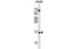 Western Blotting (WB) image for anti-Cytochrome C Oxidase Subunit VIIa Polypeptide 2 Like (COX7A2L) antibody (ABIN2996672)