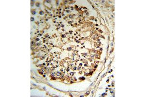 TPA Antibody (RB18787) IHC analysis in formalin fixed and paraffin embedded human testis tissue followed by peroxidase conjugation of the secondary antibody and DAB staining. (PLAT antibody  (AA 371-399))