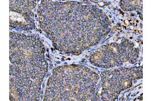 IHC analysis of ARL13B using anti-ARL13B antibody (ABIN7600179). (ARL13B antibody  (AA 16-428))