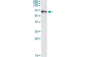 Immunoprecipitation of RIOK3 transfected lysate using anti-RIOK3 MaxPab rabbit polyclonal antibody and Protein A Magnetic Bead , and immunoblotted with RIOK3 purified MaxPab mouse polyclonal antibody (B01P) . (RIOK3 antibody  (AA 1-519))