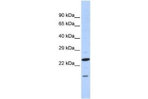 Western Blotting (WB) image for anti-Insulin Induced Gene 2 (INSIG2) antibody (ABIN2458474) (INSIG2 antibody)