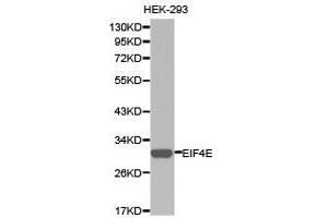Western Blotting (WB) image for anti-Eukaryotic Translation Initiation Factor 4E (EIF4E) antibody (ABIN1872499) (EIF4E antibody)