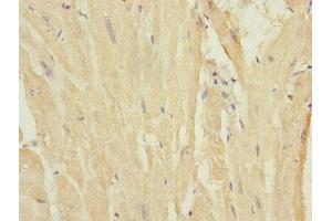 Immunohistochemistry of paraffin-embedded human heart tissue using ABIN7160546 at dilution of 1:100 (MYL7 antibody  (AA 1-175))