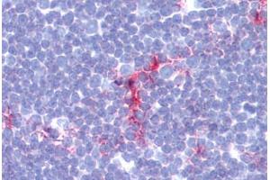 Human Thymus (formalin-fixed, paraffin-embedded) stained with CD1A antibody ABIN462117 at 1:100-1:200 followed by biotinylated goat anti-rabbit IgG secondary antibody ABIN481713, alkaline phosphatase-streptavidin and chromogen. (CD1a antibody)