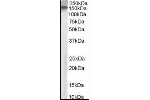 Image no. 1 for anti-Receptor Protein Tyrosine Phosphatase (PTPRT) (Internal Region) antibody (ABIN372866) (PTPRT antibody  (Internal Region))