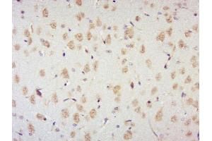 Paraformaldehyde-fixed, paraffin embedded rat brain, Antigen retrieval by boiling in sodium citrate buffer (pH6) for 15min, Block endogenous peroxidase by 3% hydrogen peroxide for 30 minutes, Blocking buffer (normal goat serum) at 37°C for 20min, Antibody incubation with p70 S6 Kinase Beta (Thr444 + Ser447) Antibody, Unconjugated  at 1:400 overnight at 4°C, followed by a conjugated secondary and DAB staining. (RPS6KB2 antibody  (pSer447, pThr444))