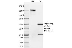 SDS-PAGE AnalysisPurified CD35 Mouse Monoclonal Antibody (To5). (CD35 antibody)