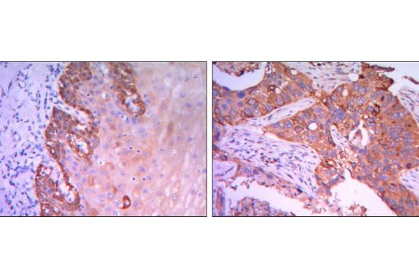 RAB25 antibody