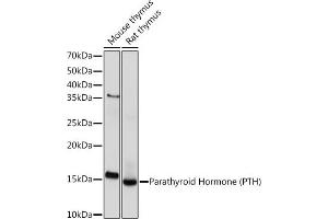 Western blot analysis of extracts of various cell lines, using Parathyroid Hormone (PTH) (PTH) Rabbit mAb (ABIN7269175) at 1:1000 dilution. (PTH antibody)