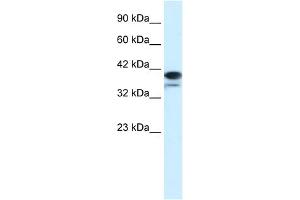 WB Suggested Anti-PAntibody Titration:  1. (PARP6 antibody  (N-Term))
