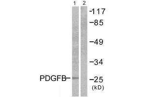 Western Blotting (WB) image for anti-Platelet Derived Growth Factor Subunit B (PDGFB) (Internal Region) antibody (ABIN1848736) (PDGFB antibody  (Internal Region))