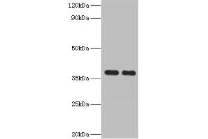 Western blot All lanes: GALM antibody at 2 μg/mL Lane 1: Mouse kidney tissue Lane 2: Rat adrenal gland tissue Secondary Goat polyclonal to rabbit IgG at 1/10000 dilution Predicted band size: 38 kDa Observed band size: 38 kDa (GALM antibody  (AA 2-342))