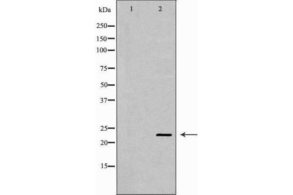 CNTF antibody  (C-Term)