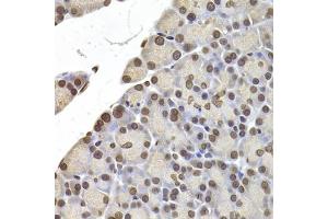Immunohistochemistry of paraffin-embedded rat pancreas using LMNB2 Antibody (ABIN5973877) at dilution of 1/200 (40x lens). (Lamin B2 antibody)