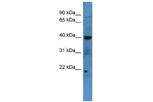 WB Suggested Anti-MRGPRX3 Antibody Titration: 0. (MRGPRX3 antibody  (C-Term))