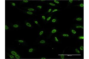 Immunofluorescence of monoclonal antibody to DLX1 on HeLa cell. (DLX1 antibody  (AA 152-255))