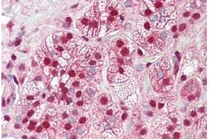 Anti-HnRNP K antibody IHC staining of human adrenal.