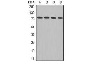 Western blot analysis of ADAM33 expression in Hela (A), MCF7 (B), mouse brain (C), rat heart (D) whole cell lysates.
