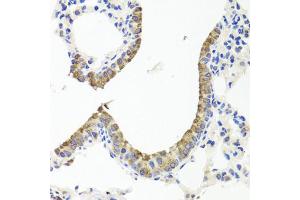 Immunohistochemistry of paraffin-embedded mouse lung using TTR antibody (ABIN5970470) at dilution of 1/100 (40x lens). (TTR antibody)