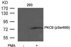 Western blot analysis of extracts from 293 cells untreated or treated with PMA using PKCth(Phospho-Ser695) Antibody. (PKC theta antibody  (pSer695))