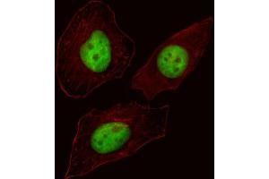 Immunofluorescence (IF) image for anti-Forkhead Box N3 (FOXN3) antibody (ABIN3000811) (FOXN3 antibody)