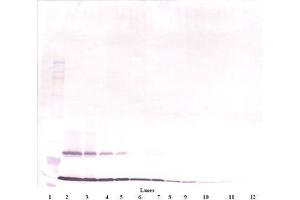 Image no. 3 for anti-Thymic Stromal Lymphopoietin (TSLP) antibody (ABIN465621) (Thymic Stromal Lymphopoietin antibody)