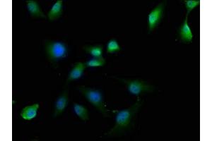 Immunofluorescence staining of U251 cells with ABIN7162330 at 1:50, counter-stained with DAPI. (OTUD3 antibody  (AA 108-398))