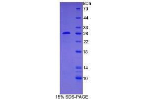 SDS-PAGE of Protein Standard from the Kit (Highly purified E. (Bcl-2 ELISA Kit)