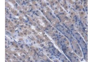 DAB staining on IHC-P; Samples: Rat Stomach Tissue (PNP antibody  (AA 1-289))