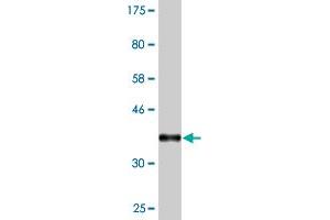 Western Blot detection against Immunogen (37. (ZBTB25 antibody  (AA 331-435))