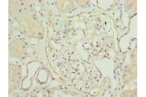 Immunohistochemistry of paraffin-embedded human kidney tissue using ABIN7173722 at dilution of 1:100 (TPPP2 antibody  (AA 1-170))