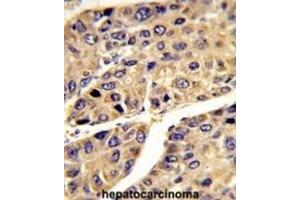 Immunohistochemistry (IHC) image for anti-Insulin-Like Growth Factor Binding Protein, Acid Labile Subunit (IGFALS) antibody (ABIN3003239) (IGFALS antibody)