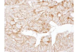 Immunohistochemistry (IHC) image for anti-Adducin 1 (Alpha) (ADD1) (AA 550-600) antibody (ABIN7453420) (alpha Adducin antibody  (AA 550-600))