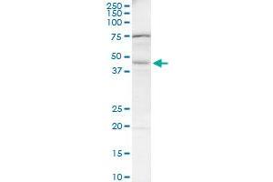 BAAT monoclonal antibody (M03), clone 1E4. (BAAT antibody  (AA 258-355))