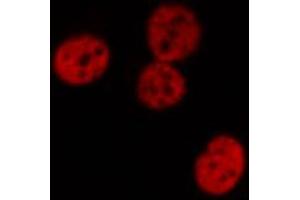 ABIN6267509 staining Hela by IF/ICC. (STAT1 antibody  (pTyr701))