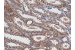 Detection of NME5 in Human Kidney Tissue using Polyclonal Antibody to Non Metastatic Cells 5, Protein NM23A Expressed In (NME5) (NME5 antibody  (AA 3-194))