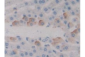 Immunohistochemistry (IHC) image for anti-Microtubule-Associated Protein 4 (MAP4) (AA 2-250) antibody (ABIN7433462)