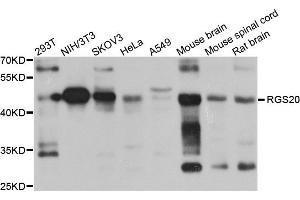 Western blot analysis of extracts of various cell lines, using RGS20 antibody (ABIN5974507) at 1/1000 dilution. (RGS20 antibody)