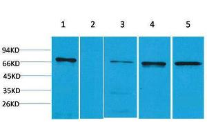Western Blotting (WB) image for anti-Zinc Finger and BTB Domain Containing 45 (ZBTB45) antibody (ABIN3181502) (ZBTB45 antibody)
