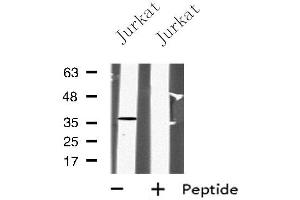 Western blot analysis of PPP2CA using Jurkat whole cell lysates (PPP2CA antibody  (C-Term))