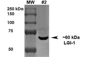Western Blot analysis of Rat Brain Membrane showing detection of ~60 kDa LGI1 protein using Mouse Anti-LGI1 Monoclonal Antibody, Clone S283-7 . (LGI1 antibody  (AA 37-113) (Biotin))